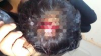 Korban saat memperlihatkan luka di bagian kepala usai dianiaya oknum polisi.(Foto : Ist).